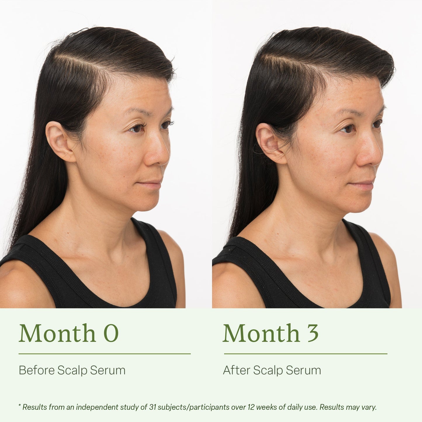 Divi Magic Scalp Revive Serum